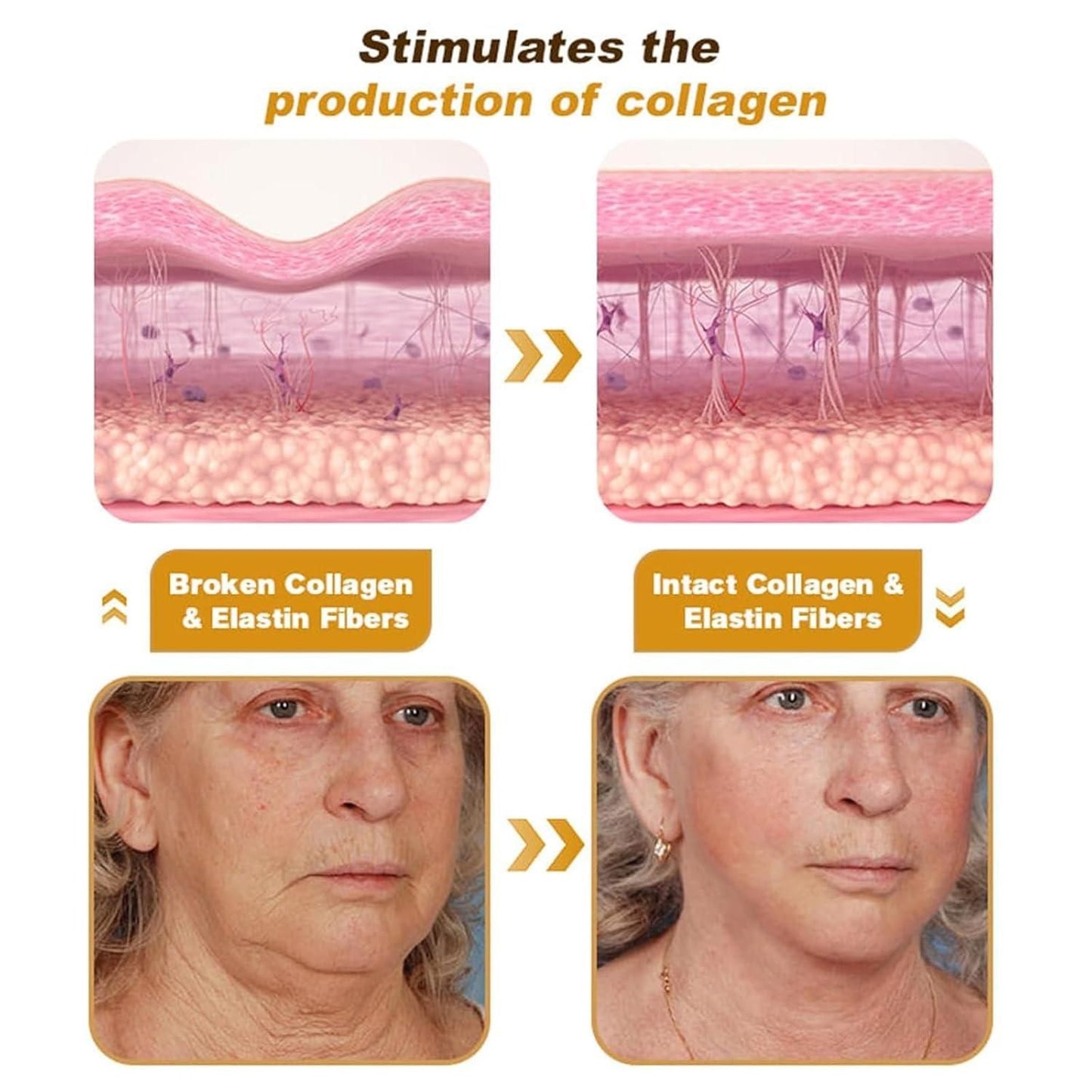 Botox Bee Venom Cream (BUY 1 GET 1 FREE)
