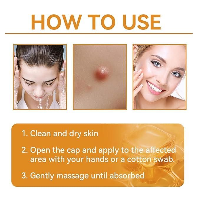 Bee Venom Skin Treatment Cream (Buy 1 Get 1 Free)