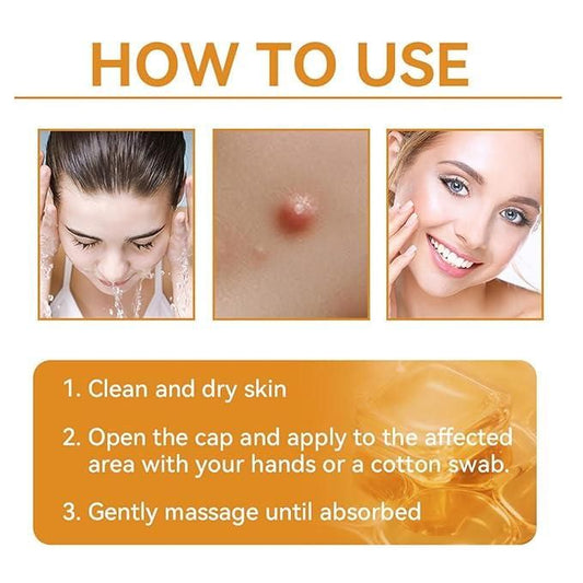 Bee Venom Skin Treatment Cream (Buy 1 Get 1 Free)