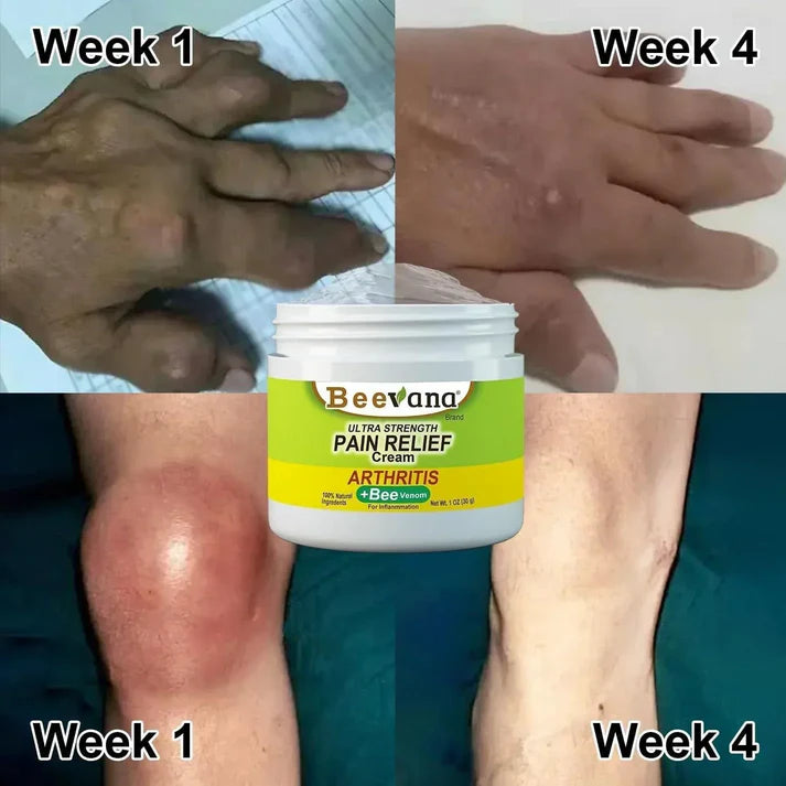 Bee Venom Joint and Bone Therapy Cream (Buy 1 Get 2 Free)